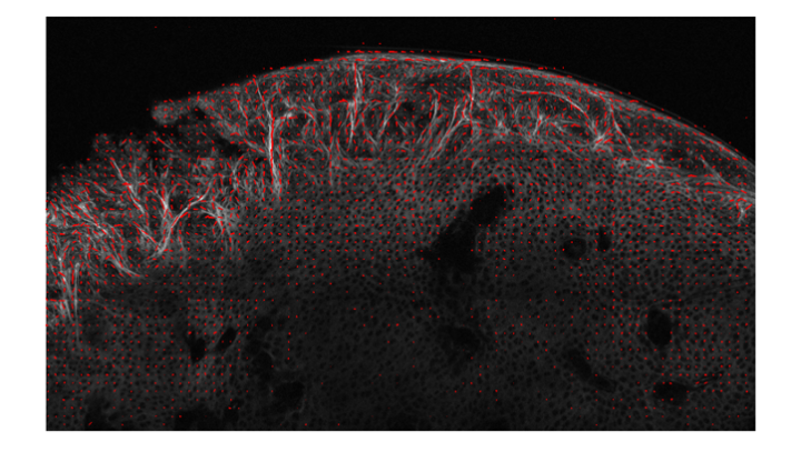 Fig.2: A multi-photon-microscope image of a knee articular cartilage.