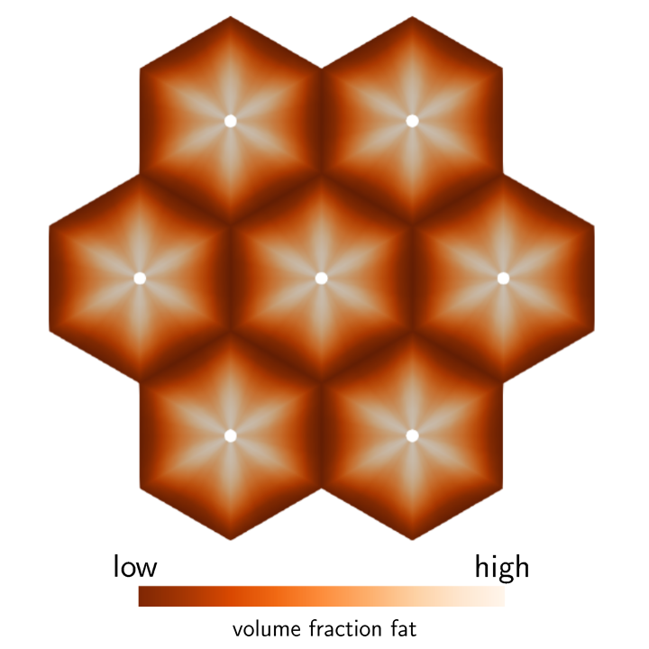 Fat distribution in liver lobule 